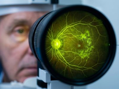 Fluorescein Angiography