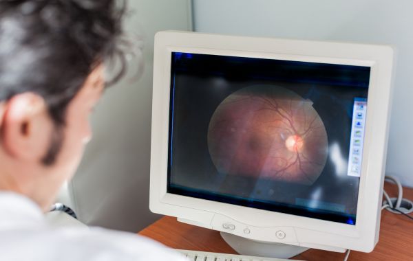 How Smoking Affects Your Retina